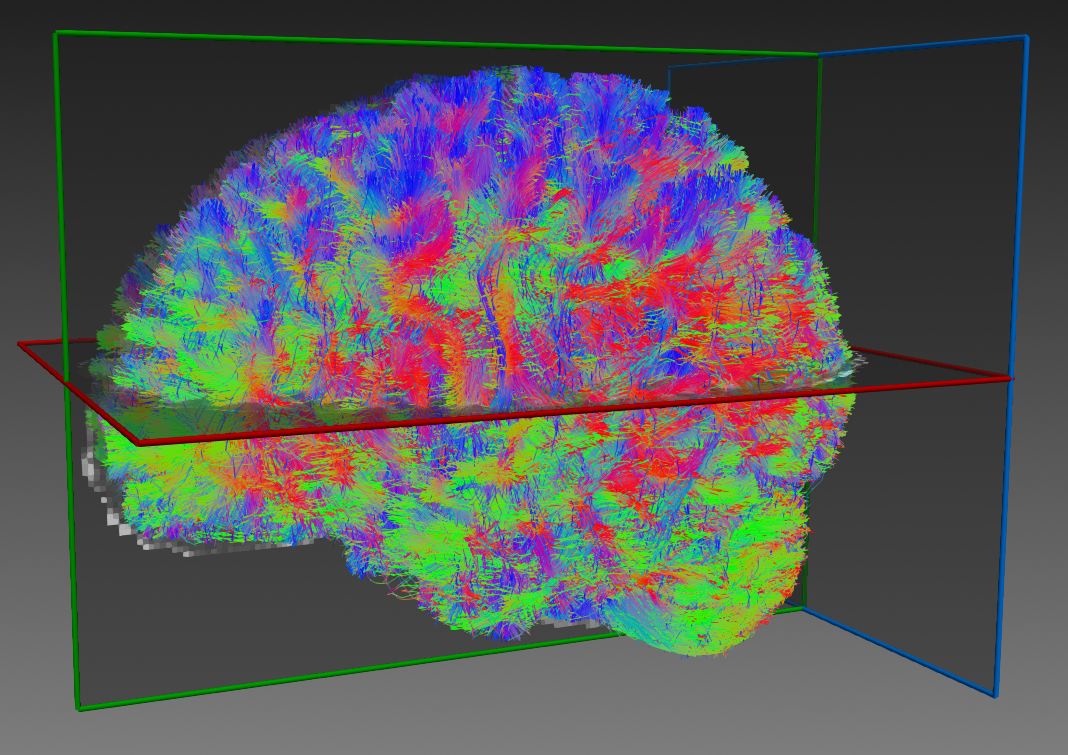 Whole brain ensemble tractogram (click to expand)
